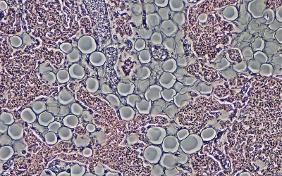 Inflammation is a Good thing?