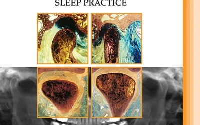 Dry needling and upper cervical spinal manipulation in patients with temporomandibular disorder: A multi-center randomized clinical trial