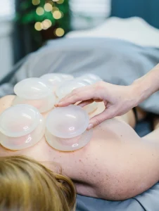 Cupping for neck and back pain in Alpharetta, GA 